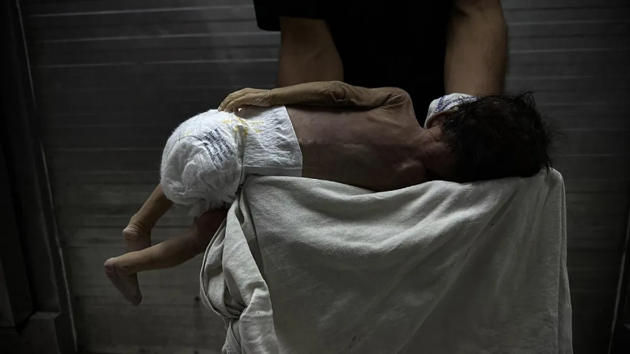 Gazze'nin En Masum Kurbanları! Yenidoğan Ünitesinde Görülmemiş Artış