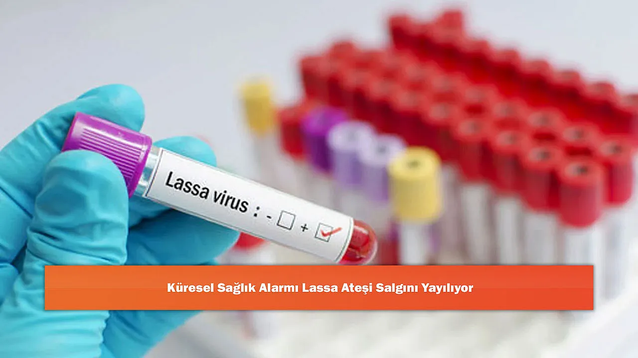 Küresel Sağlık Alarmı Lassa Ateşi Salgını Yayılıyor!