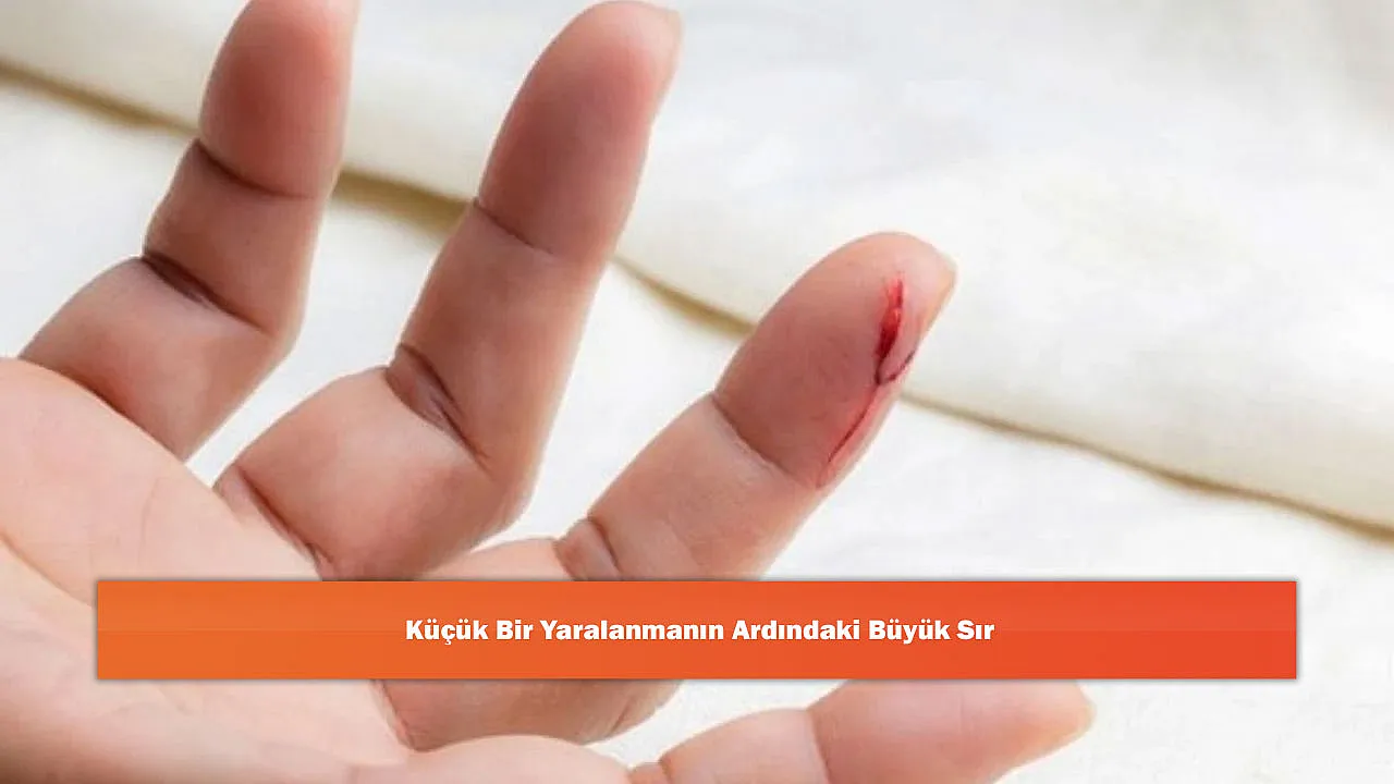 Küçük Bir Yaralanmanın Ardındaki Büyük Sır