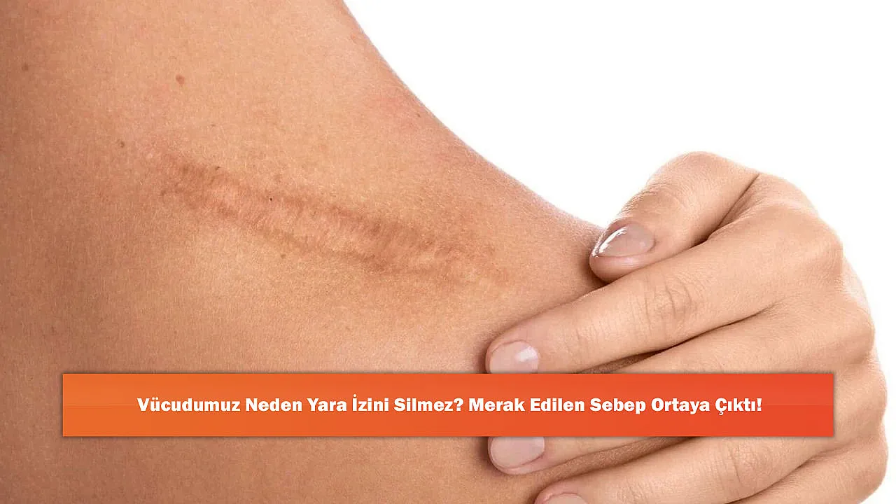 Vücudumuz Neden Yara İzini Silmez? Merak Edilen Sebep Ortaya Çıktı!