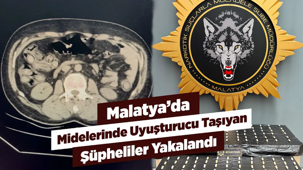 Malatya'da Uyuşturucu Operasyonu! Midelerinde Taşıdıkları 169 Kapsül Çıkarıldı