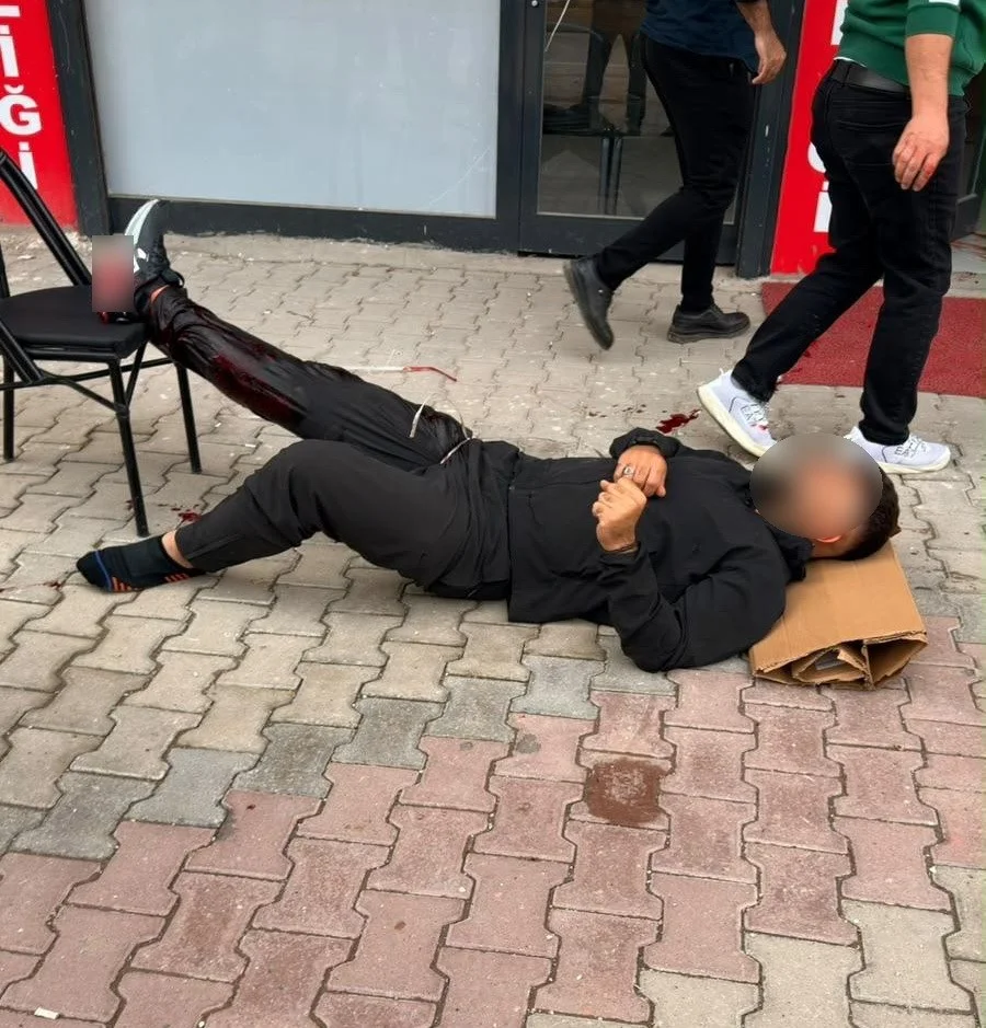Cadde ortasında silahlı saldırı: 1 yaralı