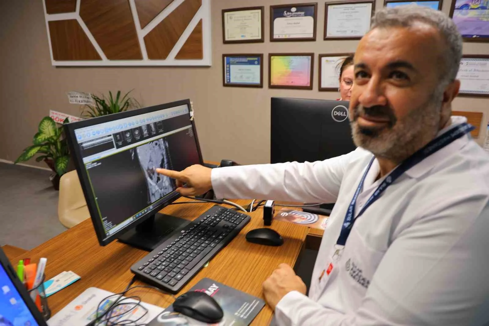 Kahramanmaraş’ta 1 yaşındaki bebeğin böbreğinden 2 santimlik taş çıkarıldı